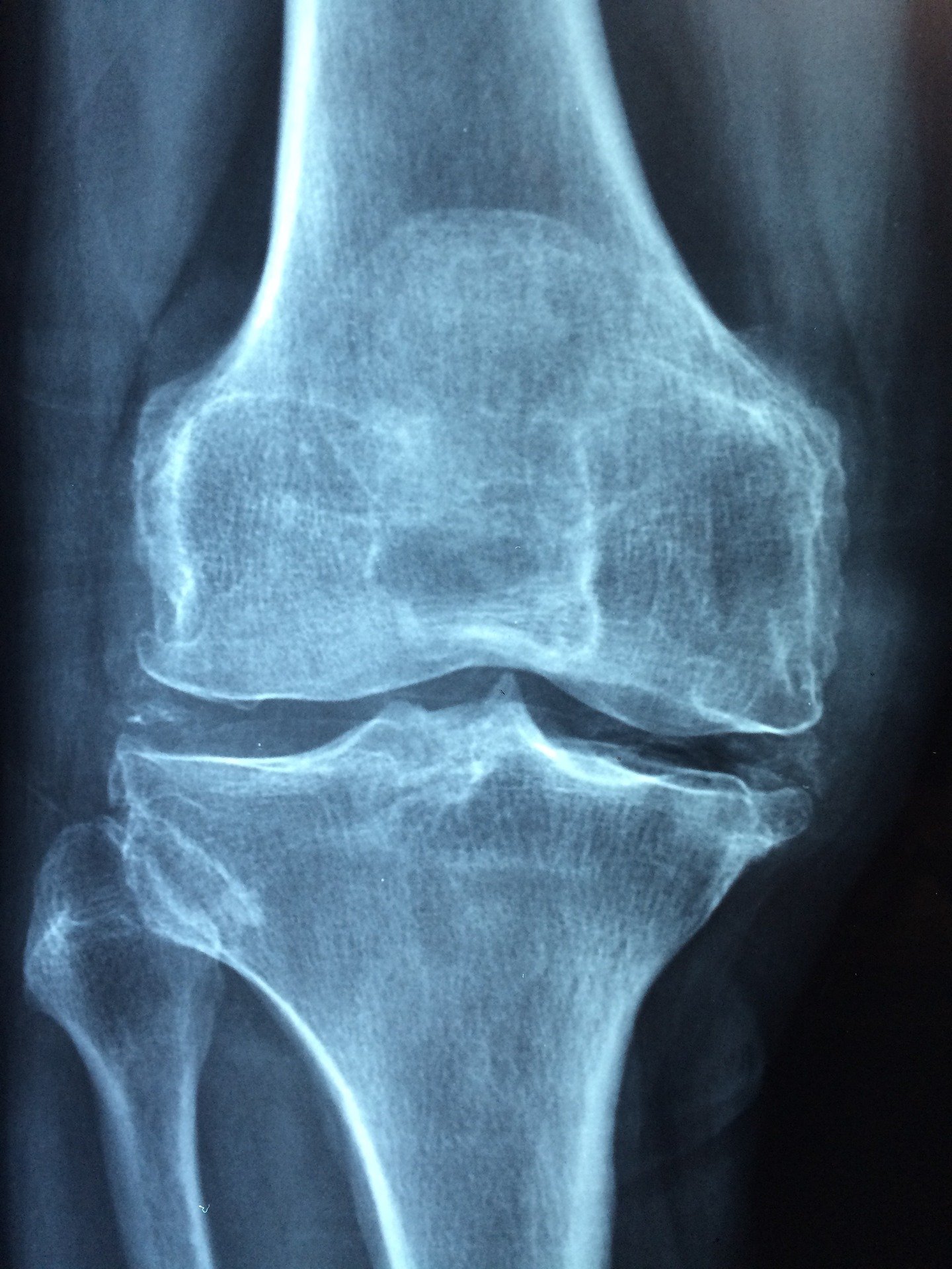 Types of Joints